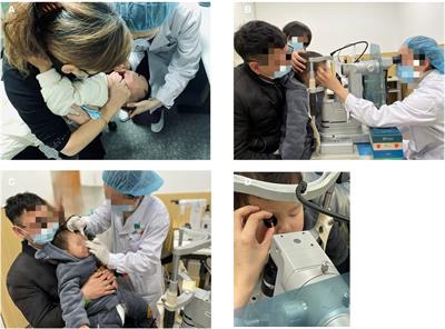 Treatment of visual axis opacification and secondary membranes with Nd:YAG laser after pediatric cataract surgery under intranasal sedation